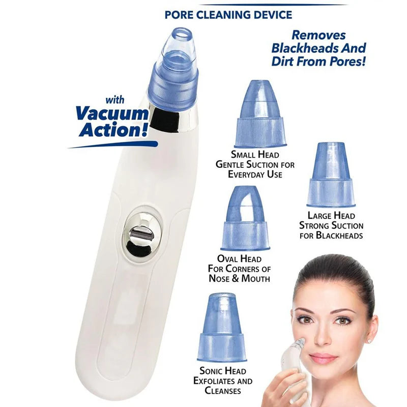 ✨ Beauty Care 4-in-1 Blackhead & Whitehead Remover