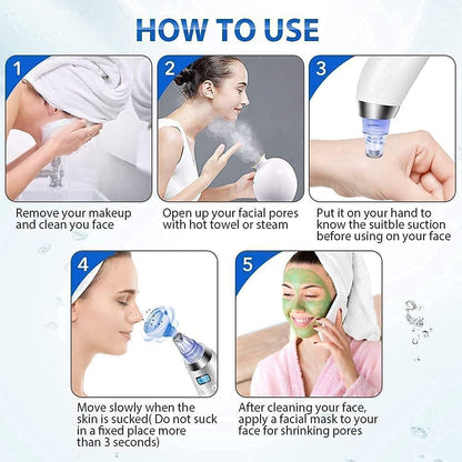 ✨ Beauty Care 4-in-1 Blackhead & Whitehead Remover